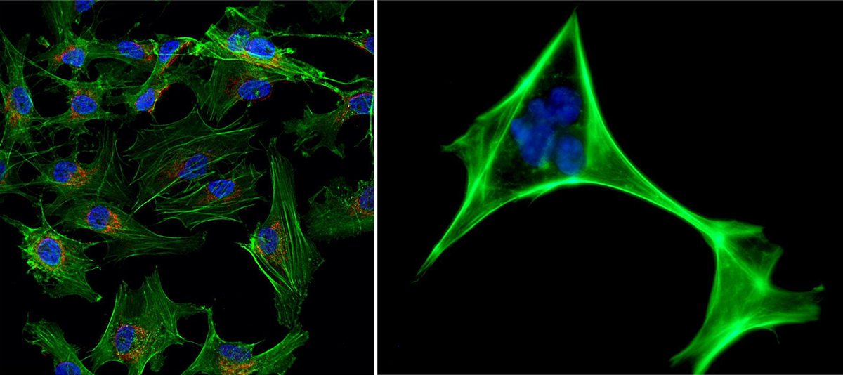 Bioluminescence  Inverted Biological Microscope